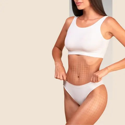 Tummy Tuck