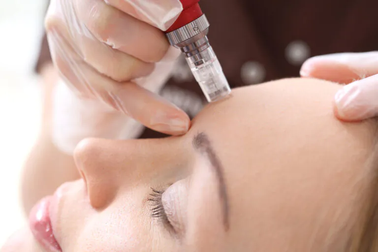 Mesotherapie – Applikation mit Mesogerät