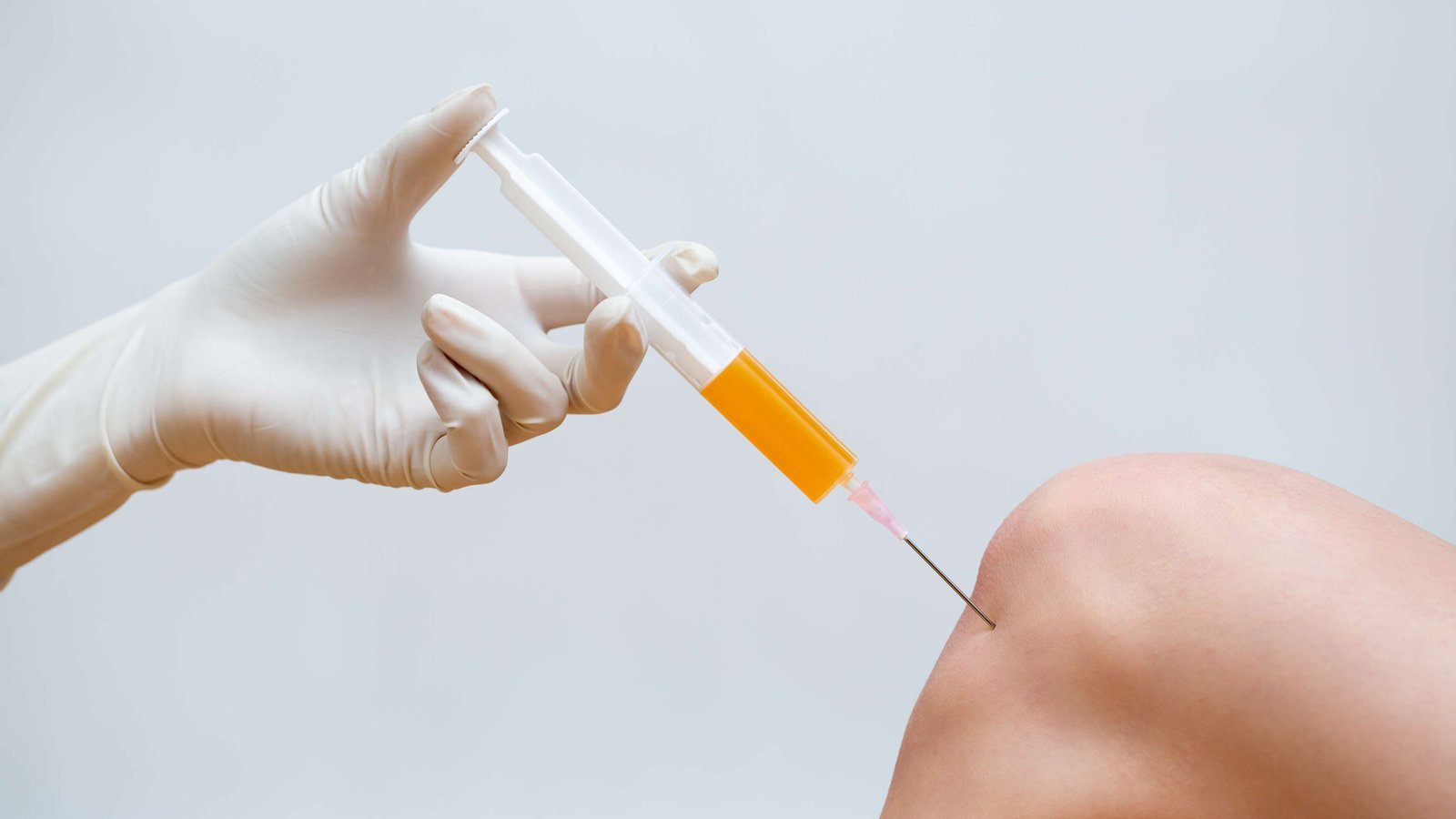 PRP-Therapie